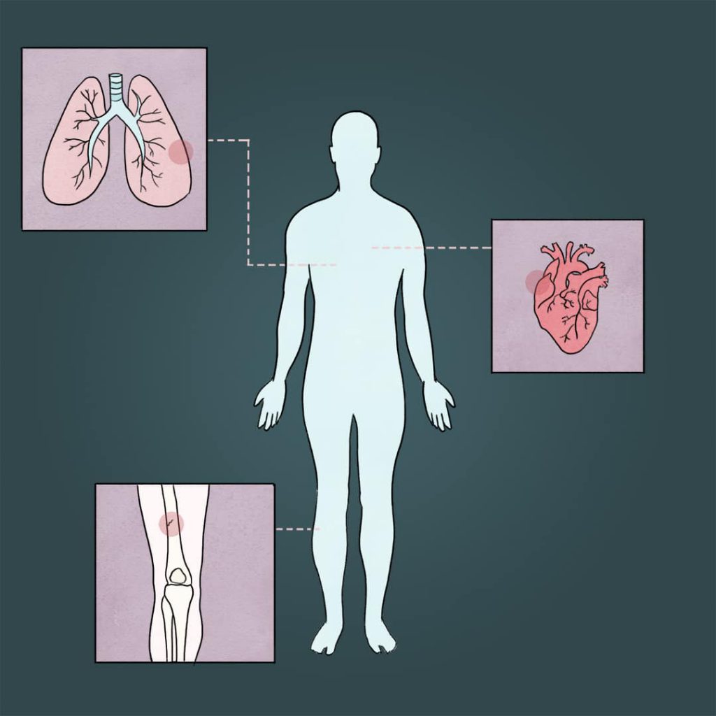 Artificial Intelligence in medicine