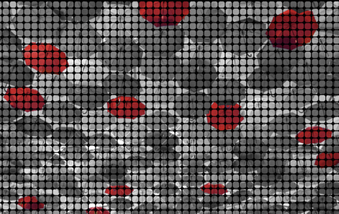 Gender Imbalance In Cancer Research Grants feature image
